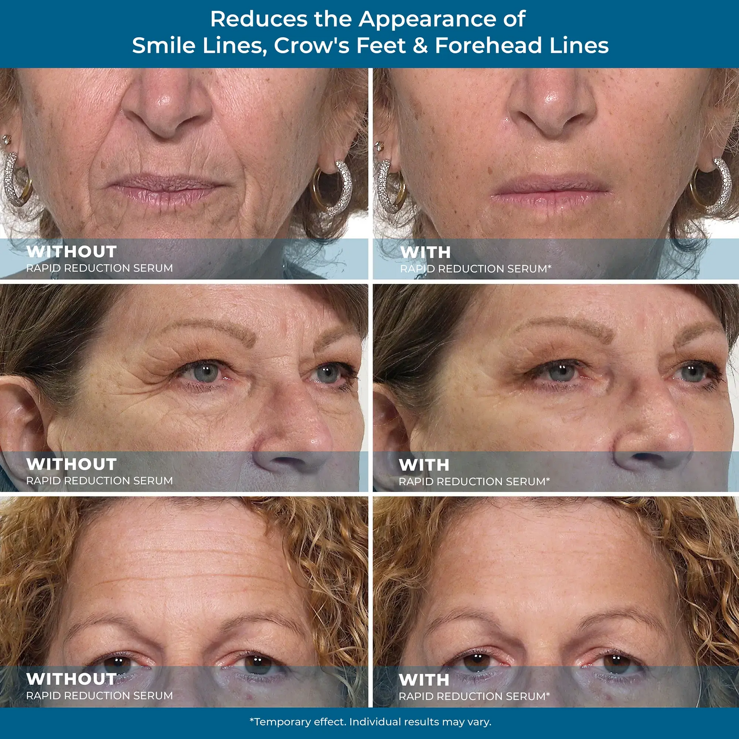 Rapid Reduction Serum – 1-Month Supply